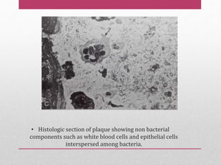 • Histologic section of plaque showing non bacterial
components such as white blood cells and epithelial cells
interspersed among bacteria.
 