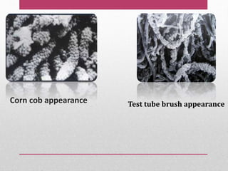 Corn cob appearance Test tube brush appearance
 