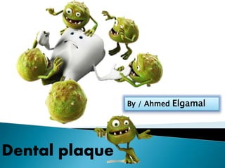 Dental plaque
By / Ahmed Elgamal
 