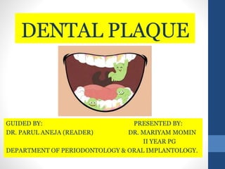 DENTAL PLAQUE
GUIDED BY: PRESENTED BY:
DR. PARUL ANEJA (READER) DR. MARIYAM MOMIN
II YEAR PG
DEPARTMENT OF PERIODONTOLOGY & ORAL IMPLANTOLOGY.
 