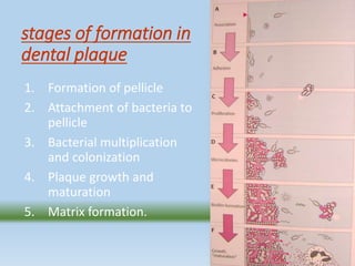 Dental plaque | PPT
