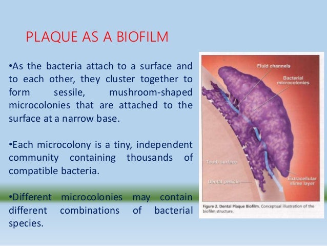 Dental plaque