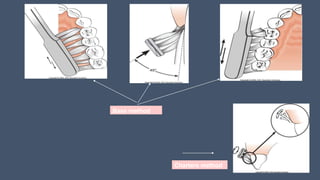 Charters method
Bass method
 