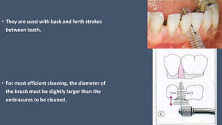 • They are used with back and forth strokes
between teeth.
• For most efficient cleaning, the diameter of
the brush must be slightly larger than the
embrasures to be cleaned.
 