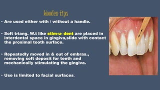 Wooden tips
• Are used either with / without a handle.
• Soft triang. W.t like stim-u- dent are placed in
interdental space in gingiva,slide with contact
the proximal tooth surface.
• Repeatedly moved in & out of embras.,
removing soft deposit for teeth and
mechanically stimulating the gingiva.
• Use is limited to facial surfaces.
 