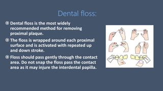 Dental floss:
 Dental floss is the most widely
recommended method for removing
proximal plaque.
 The floss is wrapped around each proximal
surface and is activated with repeated up
and down stroke.
 Floss should pass gently through the contact
area. Do not snap the floss pass the contact
area as it may injure the interdental papilla.
 