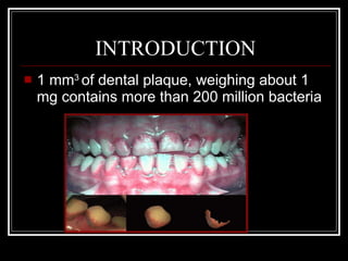 INTRODUCTION <ul><li>1 mm 3  of dental plaque, weighing about 1 mg contains more than 200 million bacteria  </li></ul>