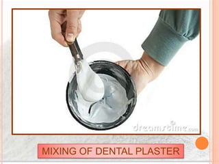 MIXING OF DENTAL PLASTER
 