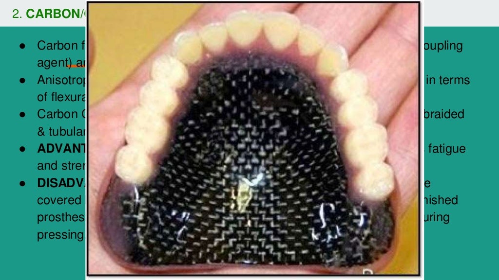 Dental polymers with recent advancements in dental base techniques 2