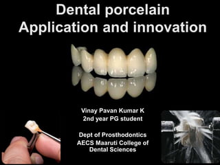 Vinay Pavan Kumar K
2nd year PG student
Dept of Prosthodontics
AECS Maaruti College of
Dental Sciences
 