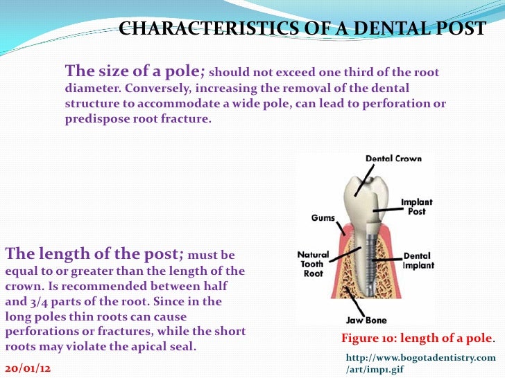 Dental post