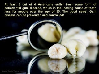 Dental Digital Posters | PDF