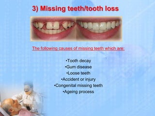 Dental problem and treatment Slide 10