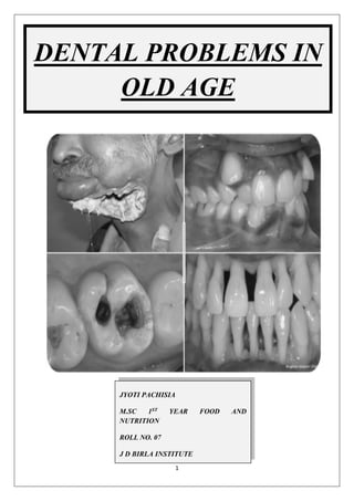 1
DENTAL PROBLEMS IN
OLD AGE
JYOTI PACHISIA
M.SC 1ST YEAR FOOD AND
NUTRITION
ROLL NO. 07
J D BIRLA INSTITUTE
 