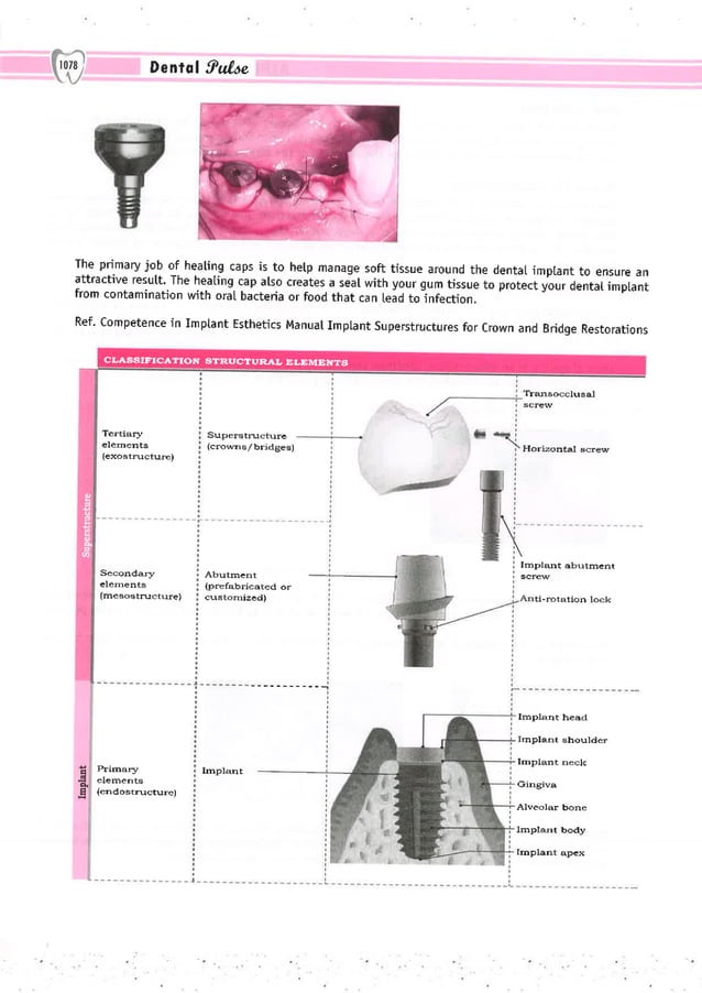 Dental Pulse_ V1_compressed.pdf
