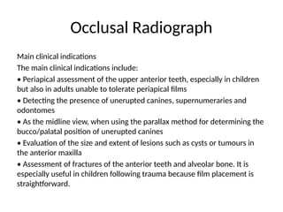 Dental_Radiographs_and_anomaly_of_Teeth[1].pptx