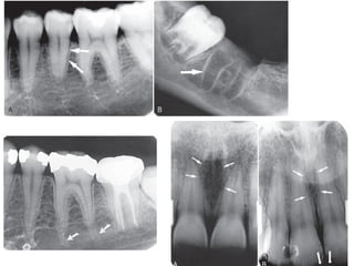 Dental_Radiographs_and_anomaly_of_Teeth[1].pptx