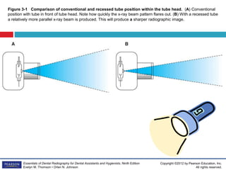 Picture Frame Pattern Radiography Dental Radiography machine.ppt