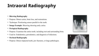 Bitewing Radiography Pdf dental radiology stomatology in bih 10.pptx