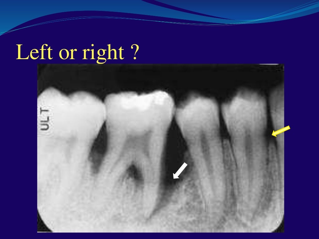 Dental radiology interactive class