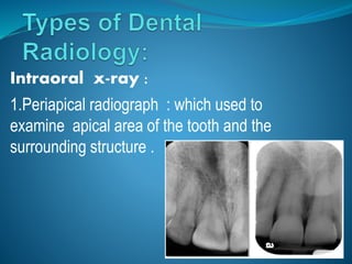 Intraoral x-ray :
1.Periapical radiograph : which used to
examine apical area of the tooth and the
surrounding structure .
 
