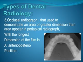 3.Occlusal radiograph : that used to
demonstrate an area of greater dimension than
area appear in periapical radiograph,
With the longest
Dimension of the film in
A anterioposterio
Position.
 