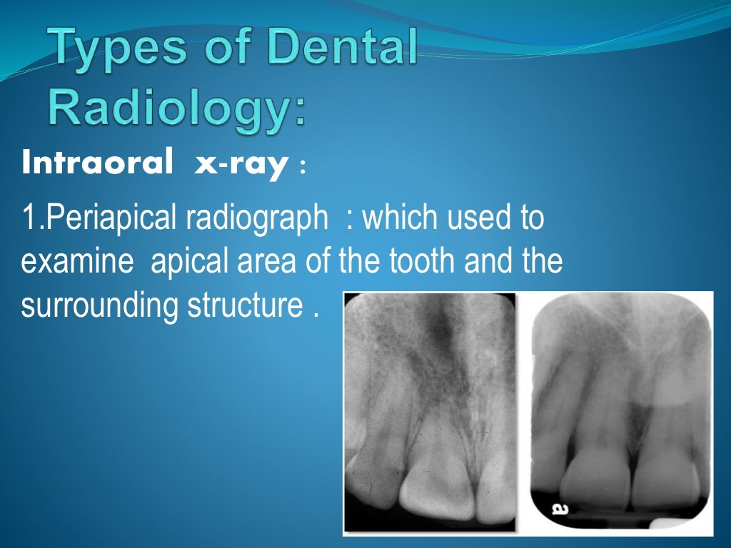 dental-radiology-ppt