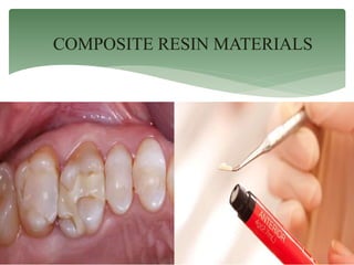 COMPOSITE RESIN MATERIALS
 