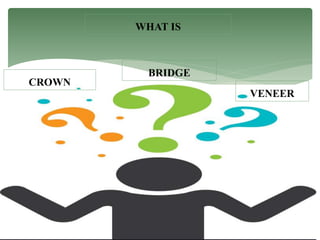 WHAT IS
BRIDGE
CROWN
VENEER
 