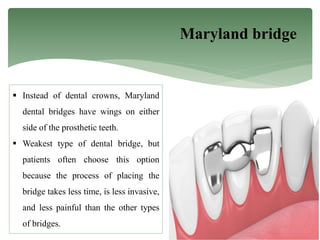 Maryland bridge
 Instead of dental crowns, Maryland
dental bridges have wings on either
side of the prosthetic teeth.
 Weakest type of dental bridge, but
patients often choose this option
because the process of placing the
bridge takes less time, is less invasive,
and less painful than the other types
of bridges.
 
