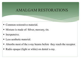 AMALGAM RESTORATIONS
 Common restorative material.
 Mixture is made of: Silver, mercury, tin.
 Inexpensive.
 Less aesthetic material.
 Absorbs most of the x-ray beams before they reach the receptor.
 Radio opaque (light or white) on dental x-ray.
 