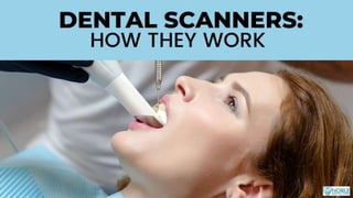 Dental Scanners How They Work