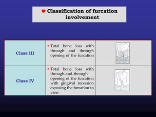  Classification of furcation
involvement
 Total bone loss with
through and through
opening of the furcation
Class III
 Total bone loss with
through-and-through
opening ot the furcation
with gingival recession
exposing the furcation to
view
Class IV
 