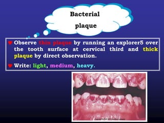 Bacterial
plaque
 Observe thin plaque by running an explorer5 over
the tooth surface at cervical third and thick
plaque by direct observation.
 Write: light, medium, heavy.
 