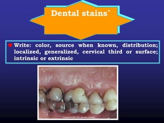 Dental stains`
 Write: color, source when known, distribution;
localized, generalized, cervical third or surface;
intrinsic or extrinsic
 
