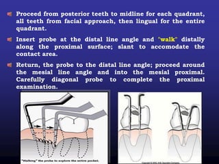 Proceed from posterior teeth to midline for each quadrant,
all teeth from facial approach, then lingual for the entire
quadrant.
Insert probe at the distal line angle and "walk" distally
along the proximal surface; slant to accomodate the
contact area.
Return, the probe to the distal line angle; proceed around
the mesial line angle and into the mesial proximal.
Carefully diagonal probe to complete the proximal
examination.
 