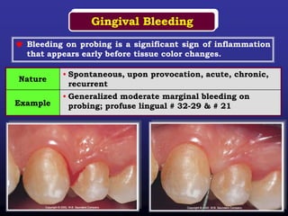 Dental sharting | PDF