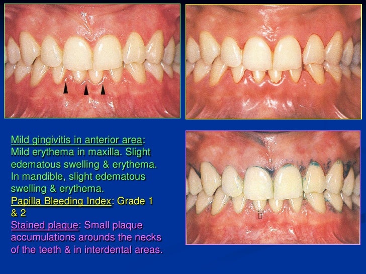 Dental Sharting