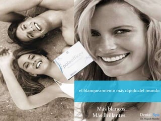 Facetas Laminadas – Diseños De Sonrisa.