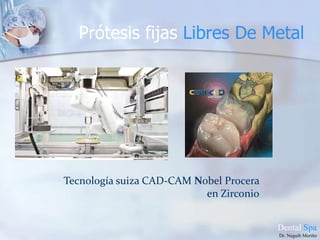 Prótesis fijas Metal – Porcelana.