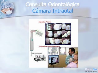 Periodoncia. Limpieza con ultrasonido.