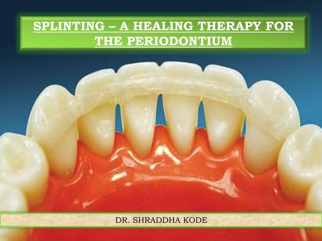 Dental splinting | PPTX
