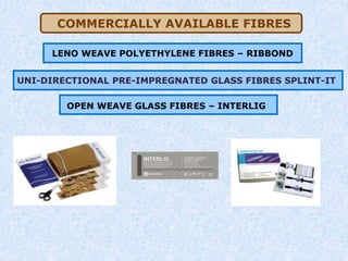 COMMERCIALLY AVAILABLE FIBRES
LENO WEAVE POLYETHYLENE FIBRES – RIBBOND
UNI-DIRECTIONAL PRE-IMPREGNATED GLASS FIBRES SPLINT-IT
OPEN WEAVE GLASS FIBRES – INTERLIG
 
