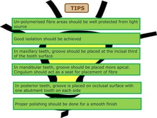 TIPS
In posterior teeth, groove is placed on occlusal surface with
one abutment tooth on each side
In mandibular teeth, groove should be placed more apical.
Cingulum should act as a seat for placement of fibre
In maxillary teeth, groove should be placed at the incisal third
of the tooth surface
Good isolation should be achieved
Un-polymerised fibre areas should be well protected from light
source
Proper polishing should be done for a smooth finish
 
