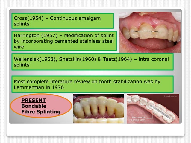 Dental splinting | PPTX