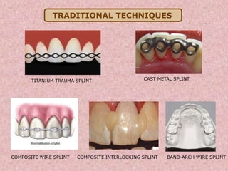 Dental splinting | PPT