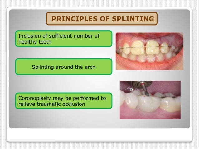 Dental Splinting