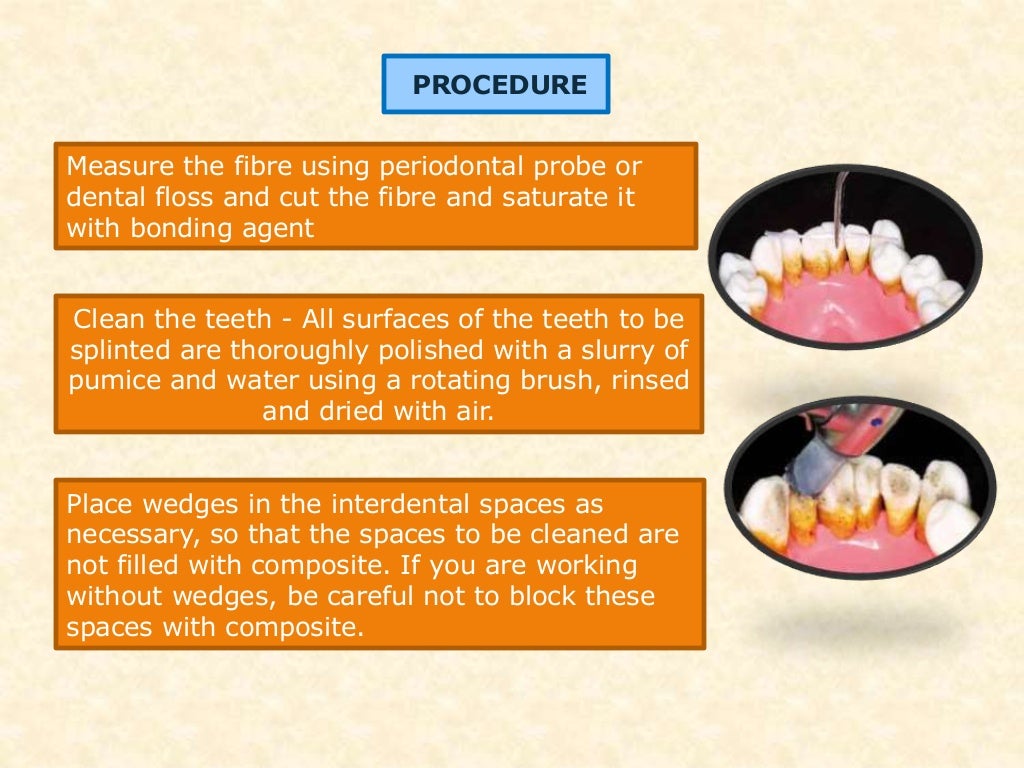Dental splinting