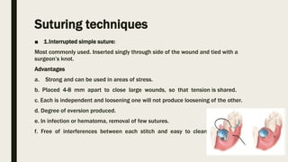 Suturing techniques
■ 1.Interrupted simple suture:
Most commonly used. Inserted singly through side of the wound and tied with a
surgeon’s knot.
Advantages
a. Strong and can be used in areas of stress.
b. Placed 4-8 mm apart to close large wounds, so that tension is shared.
c. Each is independent and loosening one will not produce loosening of the other.
d. Degree of eversion produced.
e. In infection or hematoma, removal of few sutures.
f. Free of interferences between each stitch and easy to clean.
 