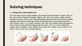 Suturing techniques
■ 8.Sling suture about single tooth
The 3/8 circle reverse cutting needle is first passed under the distal contact point of
the most distal interdental papilla (Figure 13). then the suture needle pierces
through the inner side of the elevated surgical flap 3mm from the tip of the papilla,
passage of the suture needle back under the contact point, then passed under the
next contact point in a mesial direction and then the needle pierces through the
inner surface of the elevated surgical flap 3mm from the tip of the interdental
papilla, then passage of the needle back under the contact point, tying of the
suture knot on the non elevated tissues.
 